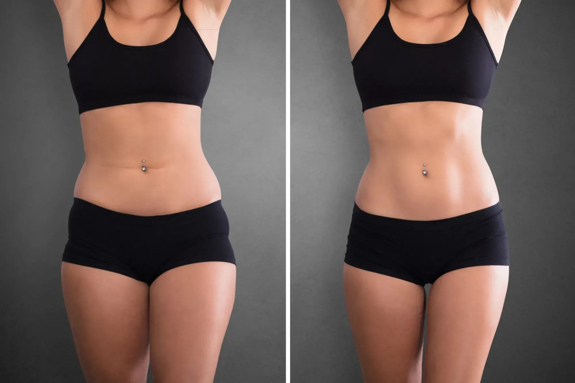 Semaglutide (GLP-1) before and after
