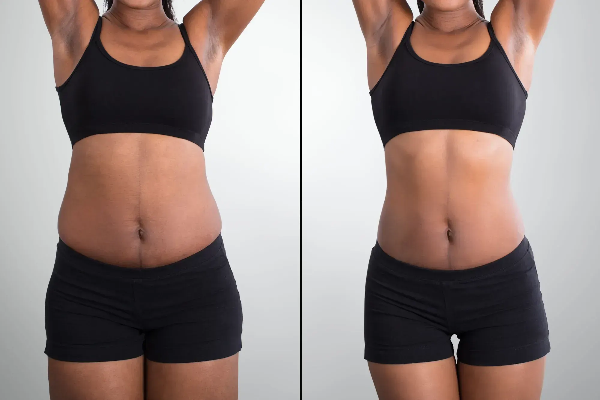 Semaglutide (GLP-1) before and after