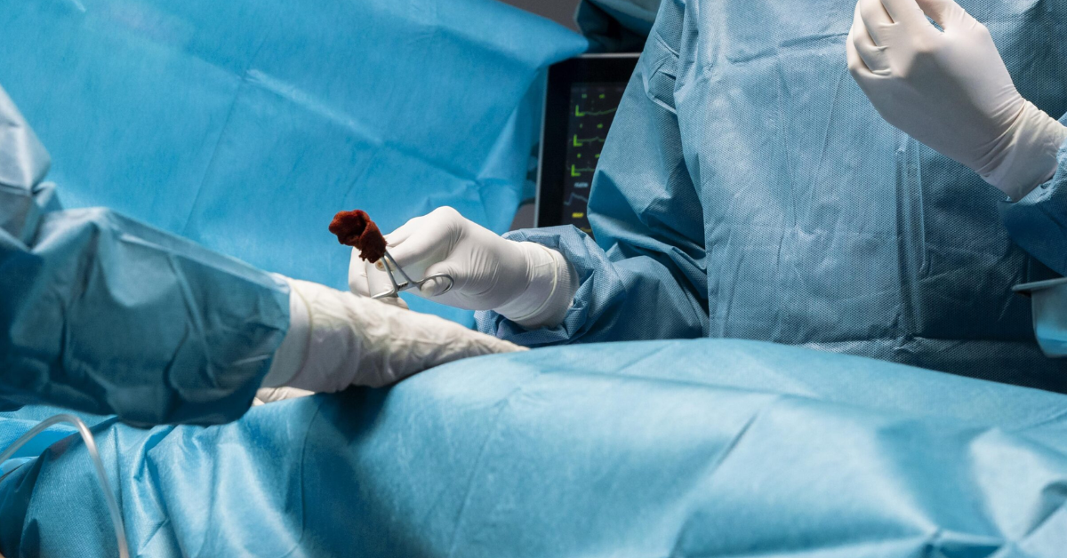 Does Single-Port Surgery Leave Scars?