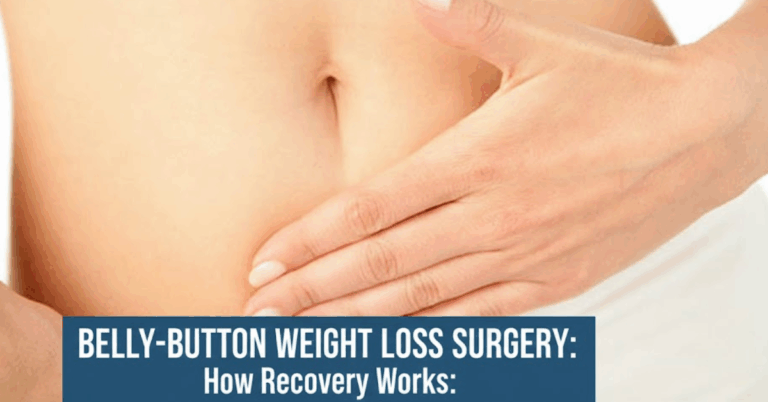 Belly-Button Weight Loss Surgery: How Recovery Works