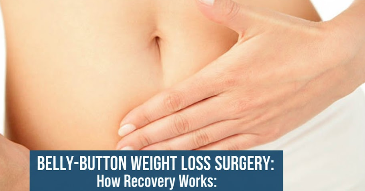 Belly-Button Weight Loss Surgery: How Recovery Works