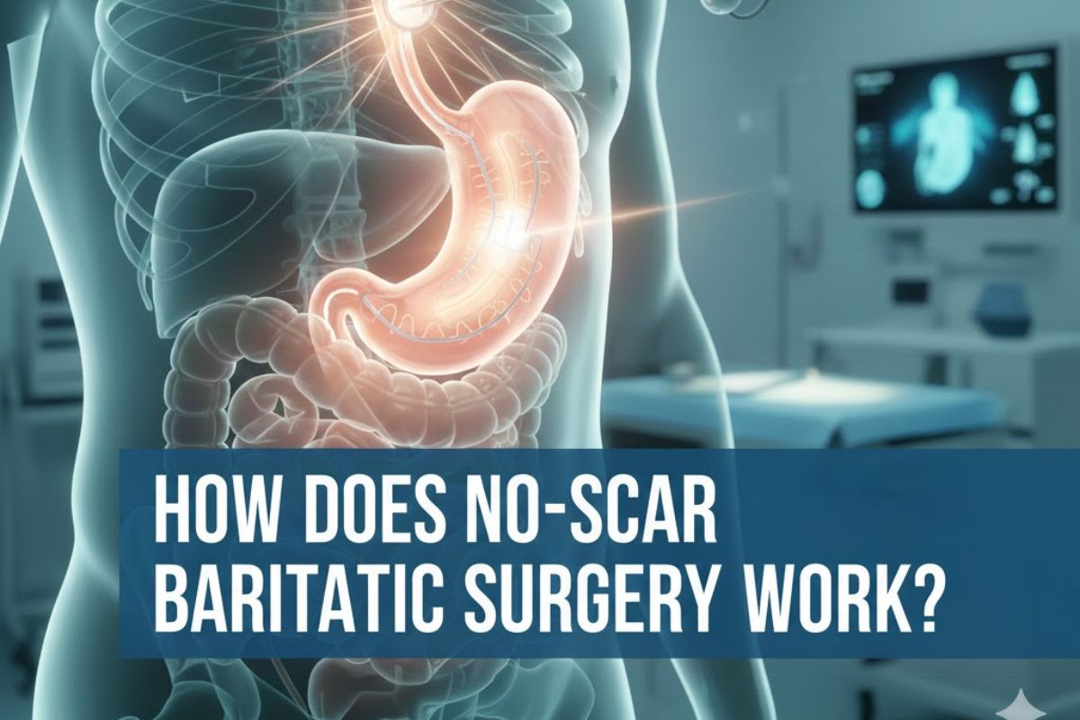 How Does No-Scar Bariatric Surgery Work? A Straightforward Guide for Georgia Patients