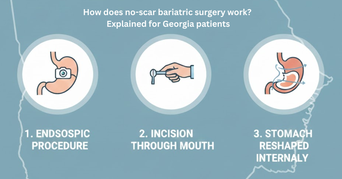 How does no-scar bariatric surgery work? Explained for Georgia patients