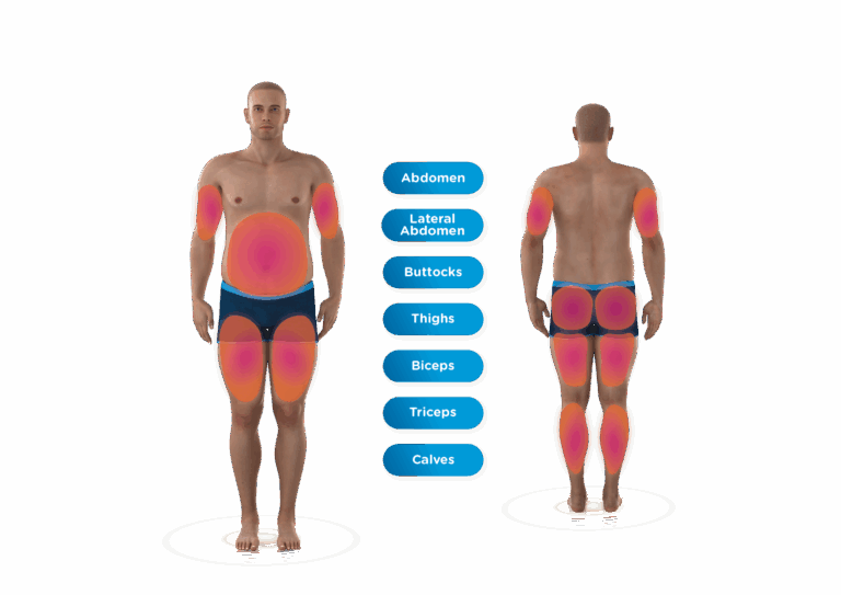 How Many EMSCULPT NEO Sessions Do You Need for Visible Results?